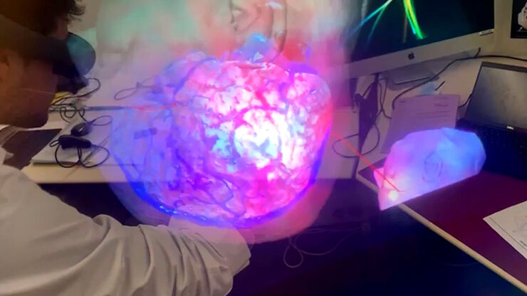 Advanced technologies support neurosurgical teaching. Image courtesy of Dr. Florian Bernard. Advanced technologies support neurosurgical teaching. Image courtesy of Dr. Florian Bernard.