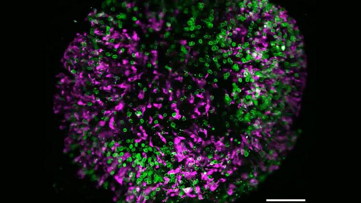 Brain organoid labeled with lamin (green) and tubulin (magenta), acquired using Viventis Deep. Courtesy of Akanksha Jain, Treutlein Lab ETH-DBSSE Basel (Switzerland).