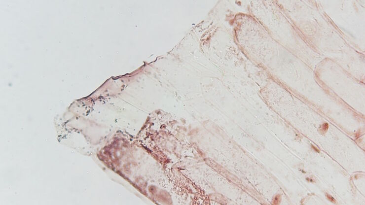 Image of an onion flake taken with a basic Leica compound microscope after it was tested for resistance to fungus and mold growth following part 11 of the ISO 9022 standard. Image of an onion flake taken with a basic Leica compound microscope after it was tested for resistance to fungus and mold growth following part 11 of the ISO 9022 standard.