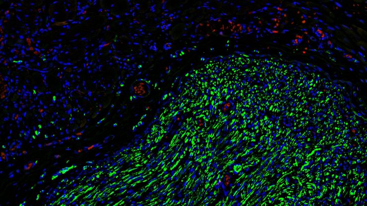 Fluorescence microscopy of sectioned tissue, showing the interface between the extensor digitorum longus muscle and the common peroneal nerve in the adult rat. Regenerative peripheral nerve interface (RPNI) at 2 weeks. Image acquired using Mica. Stained for nuclei (blue), neurofilaments (green) and S100B (red). Image courtesy of Dr. Aaron Lee, Department of Bioengineering (Lab of Dr. Rylie Green), Imperial College London.