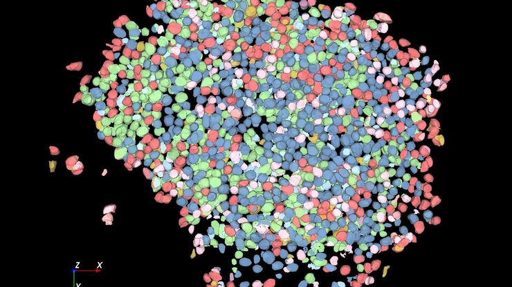 Large volume computational clearing processed Thunder image of human pancreatic islet organoid. 