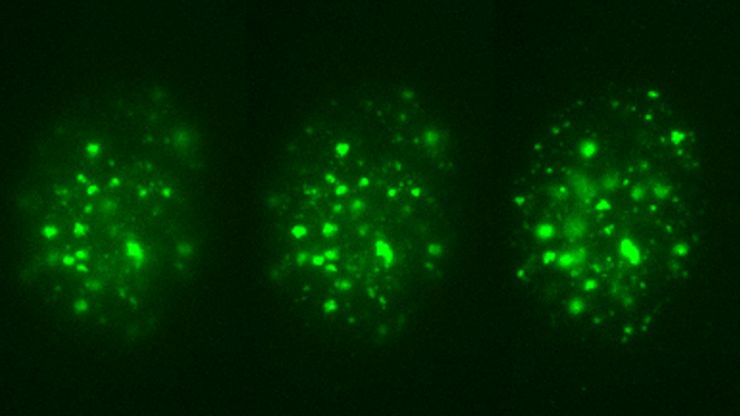 These images illustrate the need for multiple z-slices to capture all gH2Ax foci in a given cell and get an accurate count. 