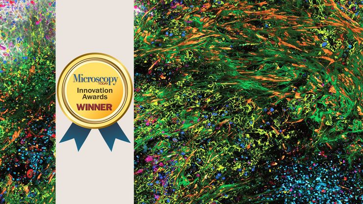 3D high-multiplex imaging in cancer immunology. Kunz L., Speziale D., et al., Nat. Methods (2024)