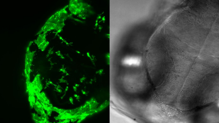 5 hour time-lapse maximum intensity projection of a zebrafish embryo along the z-axis at 3 days post fertilization. Left: microglia cells. Right: bright field channel. Courtesy of Prof. Francesca Peri, University of Zurich, Switzerland.