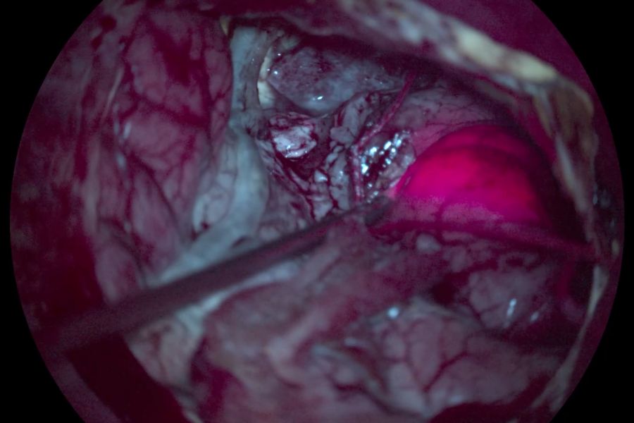 GLOW400 Augmented Reality fluorescence anatomy